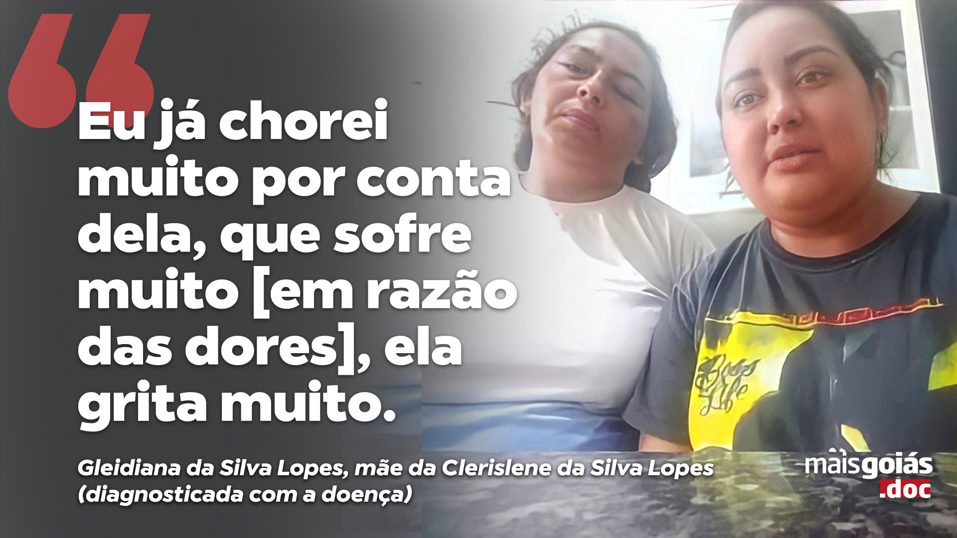 Mais Goiás.doc explora as dificuldades de pessoas diagnosticadas com Hanseníase - Mais Goiás.doc dessa semana explora as dificuldades de pessoas diagnosticadas com Hanseníase. Antigamente conhecida como Lepra, a doença é causada por uma bactéria chamada Mycobacterium leprae e atinge a pele e alguns nervos periféricos.