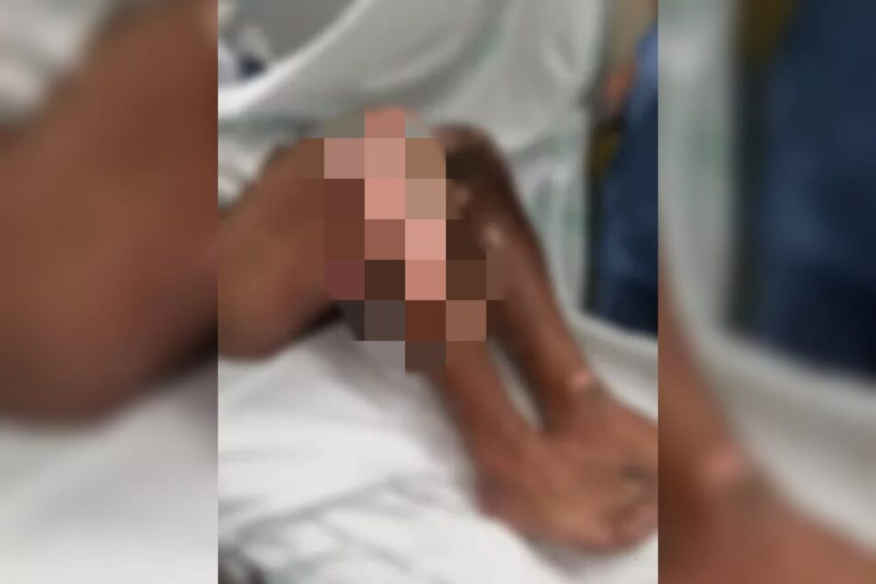 Turista tem corpo incendiado enquanto dormia na rua em Florianópolis (SC) (Foto: divulgação - PM)
