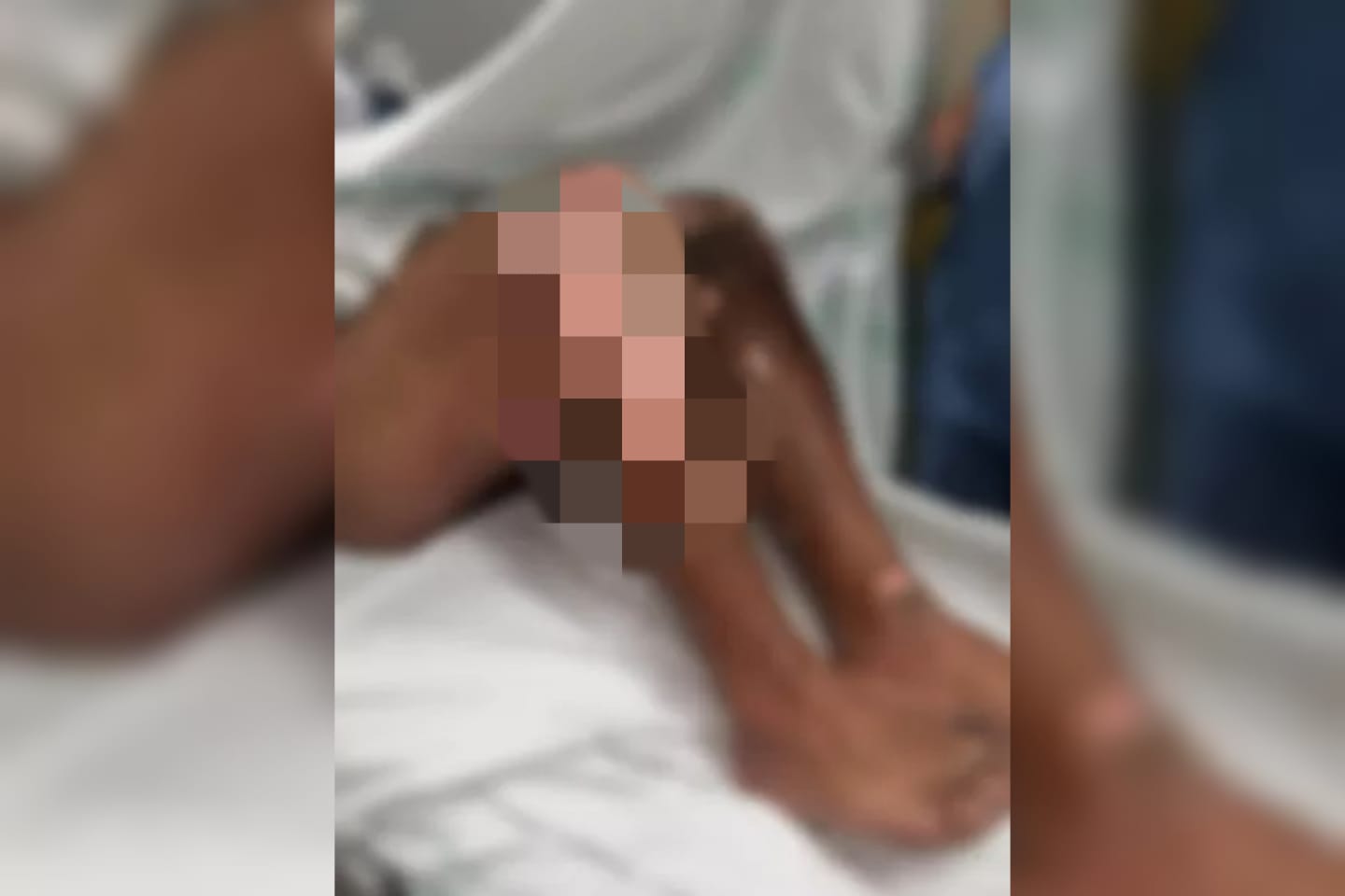 Turista tem corpo incendiado enquanto dormia na rua em Florianópolis (SC) (Foto: divulgação - PM)