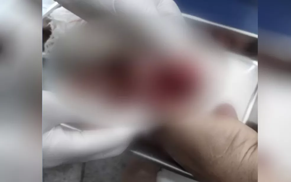 Homem perde parte do dedo após ser atacado por piranhas em lago de Buriti Alegre