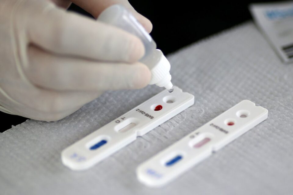Procon Goiás vai apurar possível aumento abusivo no preço de testes de Covid-19