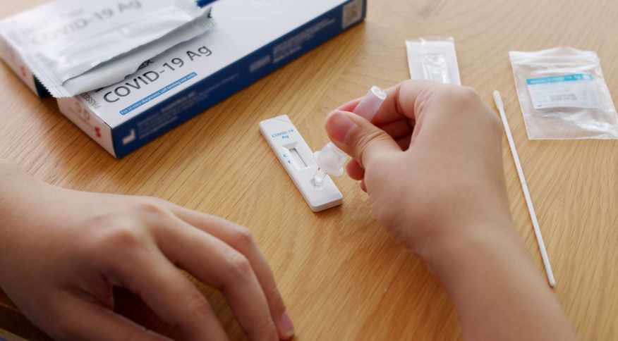 Procon-SP fiscaliza preços abusivos de testes de covid-19