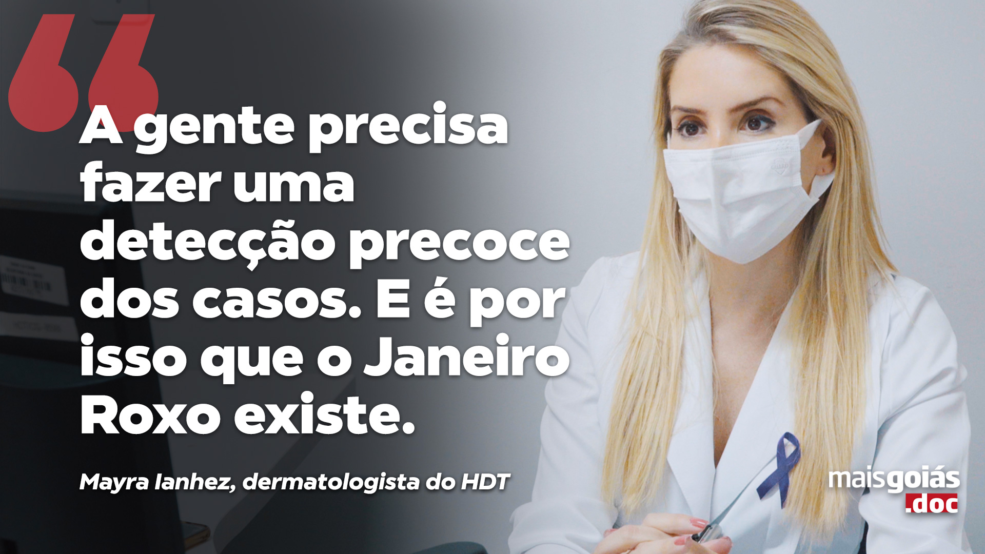 Mais Goiás.doc explora as dificuldades de pessoas diagnosticadas com Hanseníase - Mais Goiás.doc dessa semana explora as dificuldades de pessoas diagnosticadas com Hanseníase. Antigamente conhecida como Lepra, a doença é causada por uma bactéria chamada Mycobacterium leprae e atinge a pele e alguns nervos periféricos.