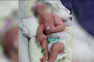 Mãe pede ajuda para tratar a filha de 1 ano que sofre de espasmos e aguarda vaga no Crer há sete meses