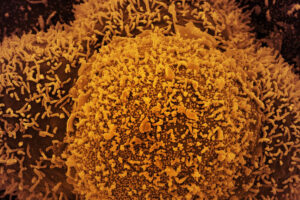 Fiocruz confirma casos da linhagem BA.2 da variante Ômicron