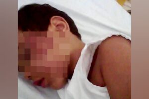 Um empresário denuncia que, há 6 anos, o filho caiu do mesmo toboágua onde uma criança morreu em um clube de Caldas Novas. (Foto: arquivo pessoal)