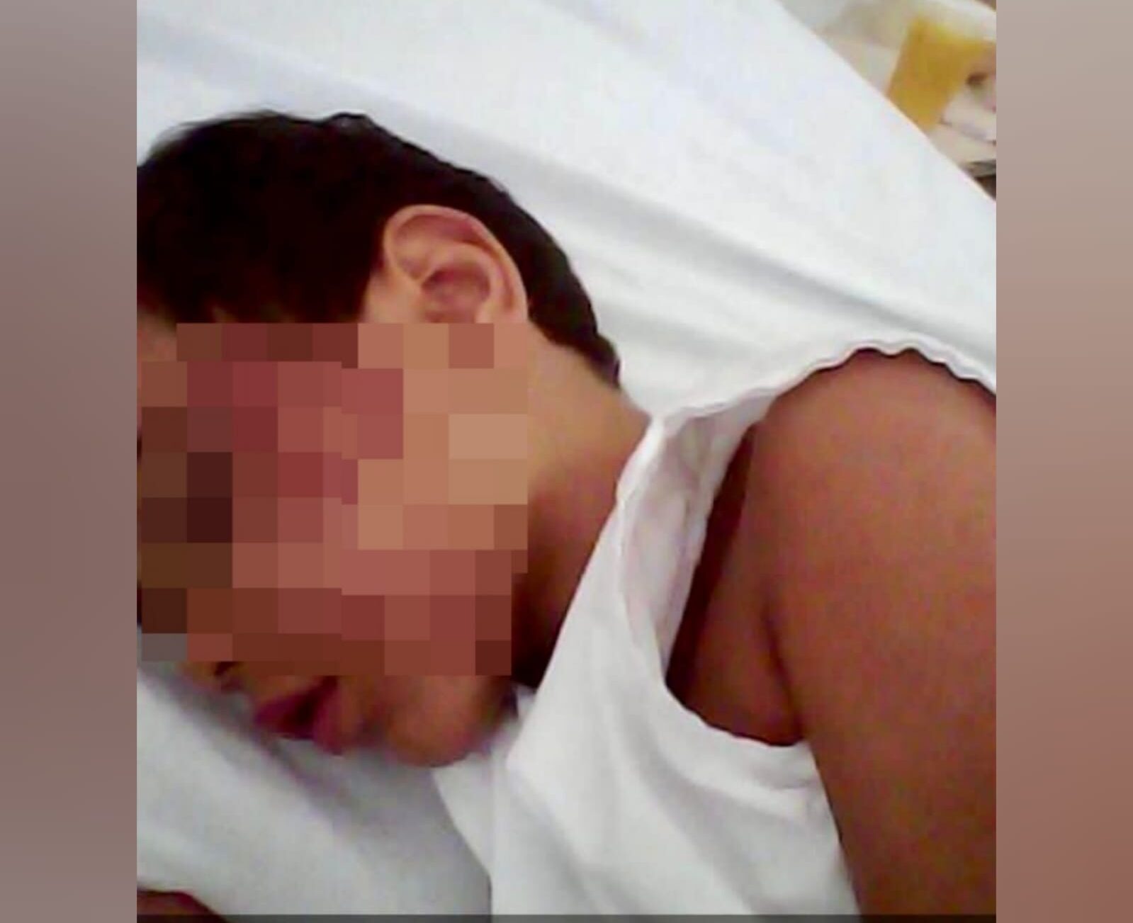 Um empresário denuncia que, há 6 anos, o filho caiu do mesmo toboágua onde uma criança morreu em um clube de Caldas Novas. (Foto: arquivo pessoal)