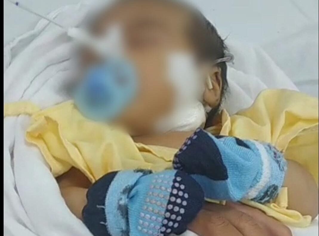 Mãe pede ajuda para conseguir doação de sangue para bebê de um mês com anemia forte