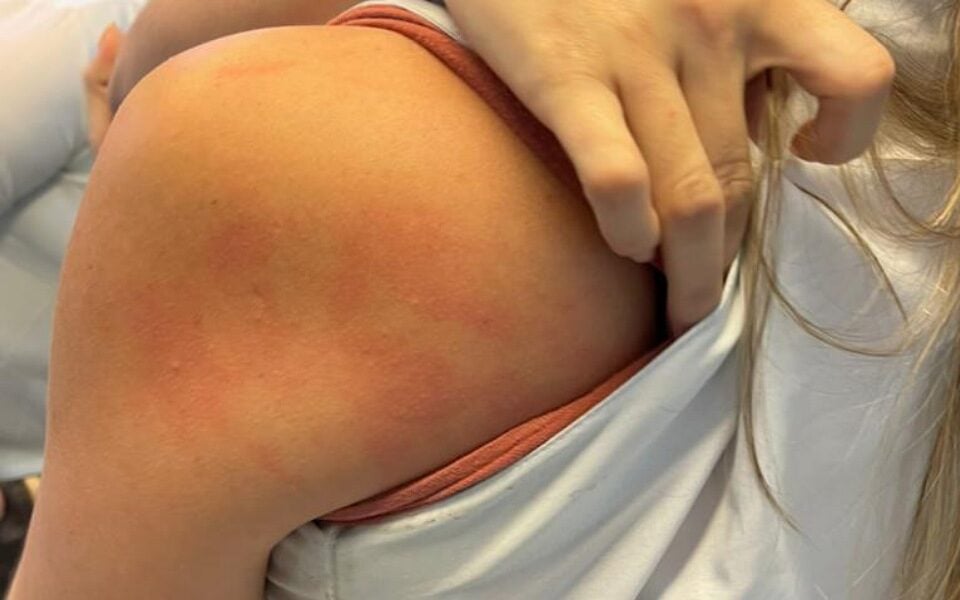 Manicure diz ter sido agredida por cliente após briga por esmalte