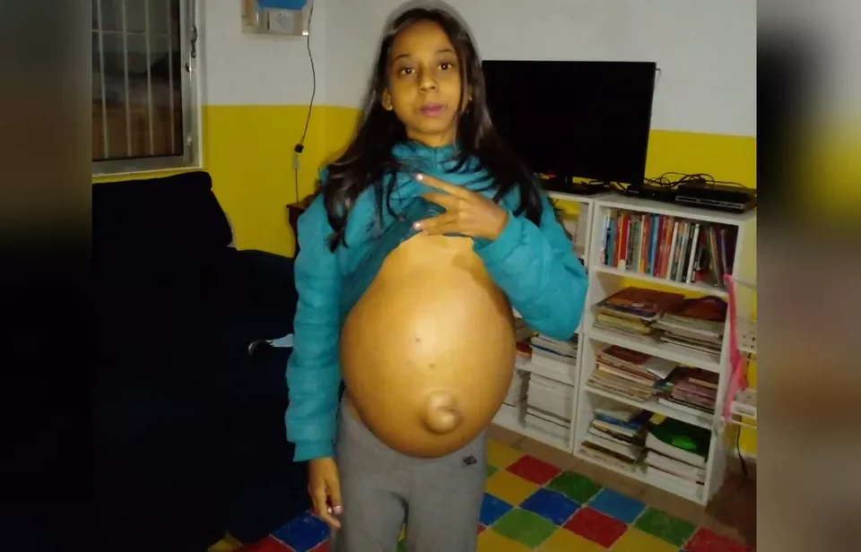 Adolescente com doença no fígado faz apelo para conseguir tratamento, em Aragoiânia
