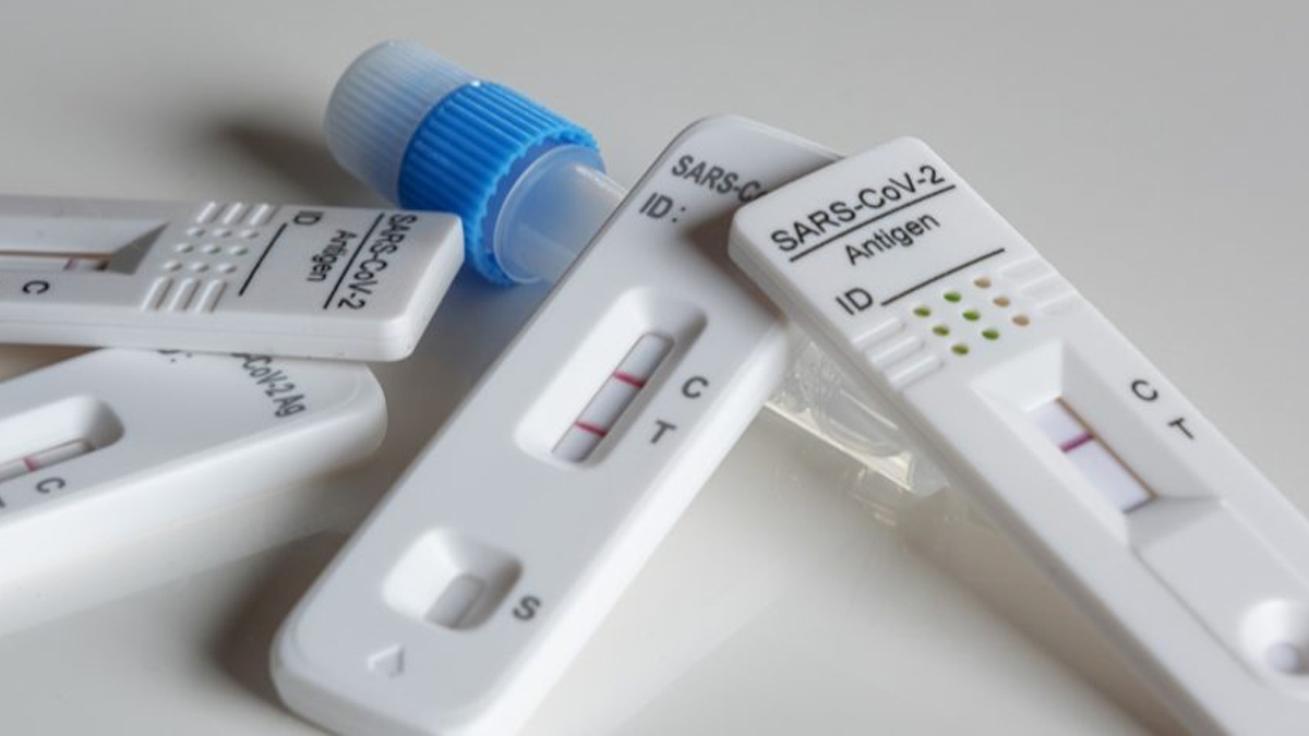 Anvisa aprova primeiro autoteste para Covid no Brasil Foto: Pixabay