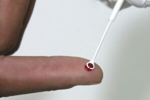 Pesquisadores da Fiocruz analisam coinfecção por HIV e HTLV na Bahia