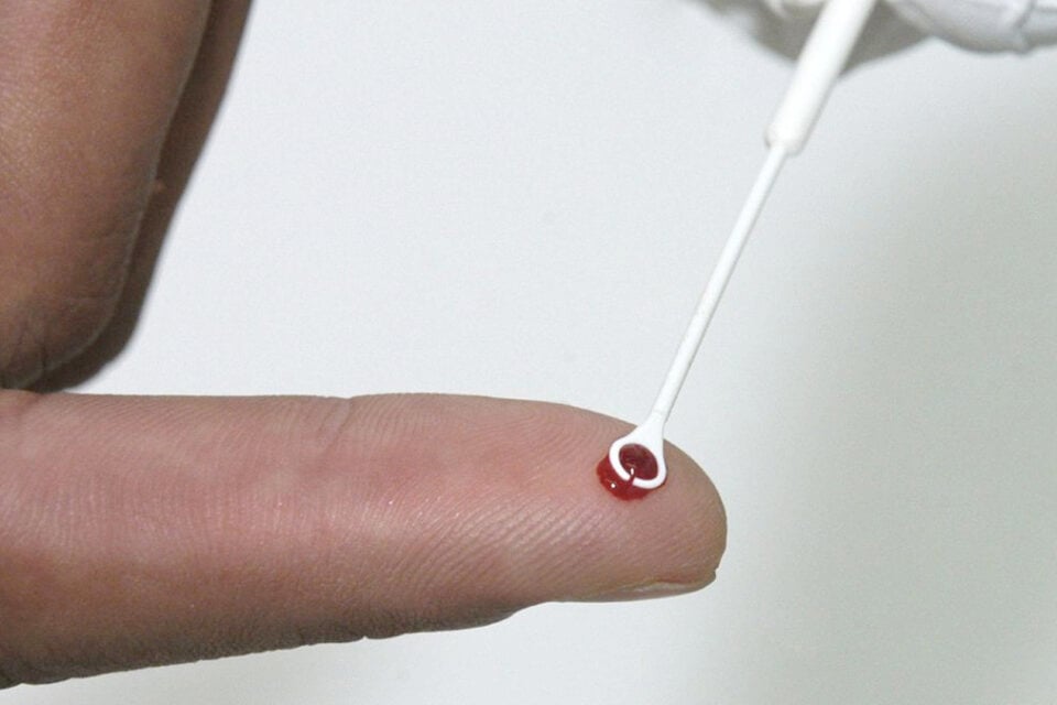 Pesquisadores da Fiocruz analisam coinfecção por HIV e HTLV na Bahia