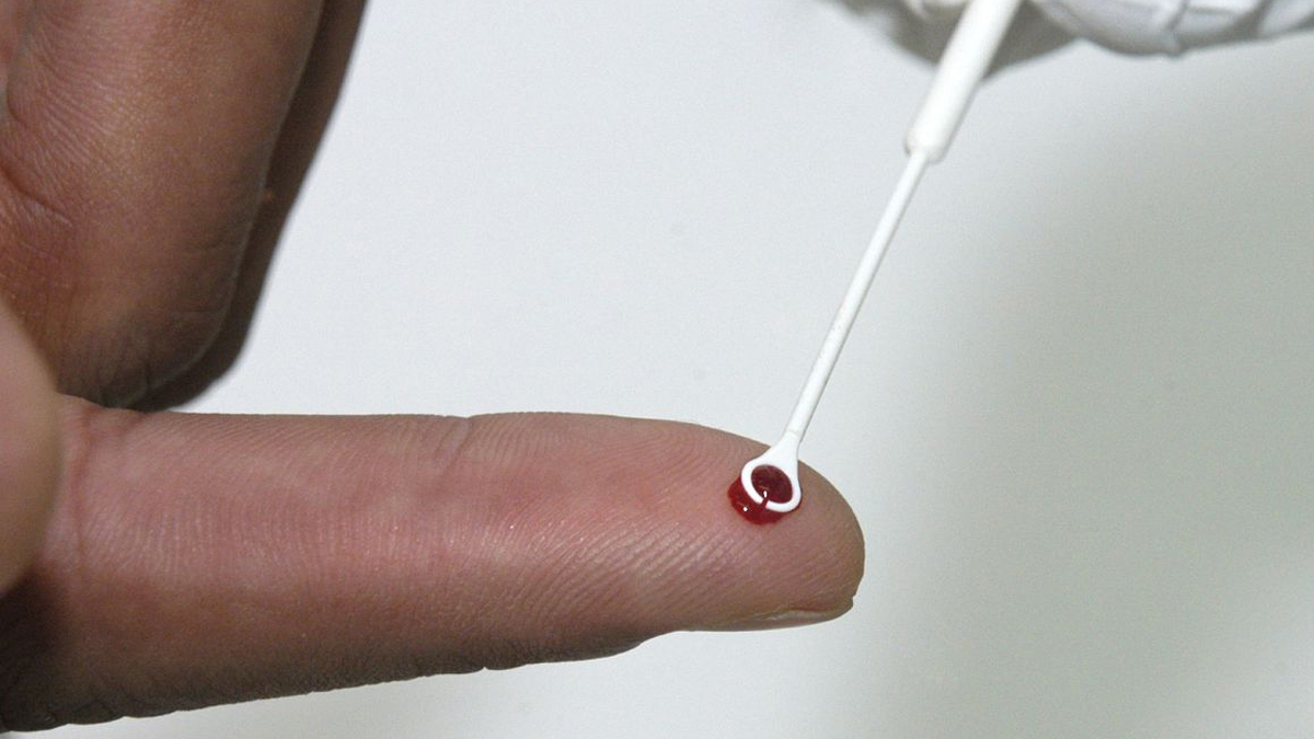 Pesquisadores da Fiocruz analisam coinfecção por HIV e HTLV na Bahia