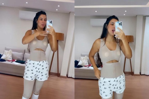 Ivy Moraes faz lipoaspiração e conta que mexeu "em tudo" 2