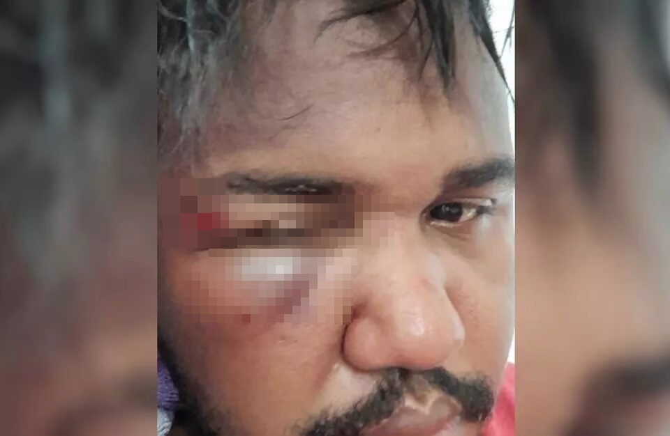 A Defensoria Pública de Goiás (DPE) instaurou procedimento para apurar as agressões a um jovem negro dentro de um supermercado em Inhumas. (Foto: reprodução)