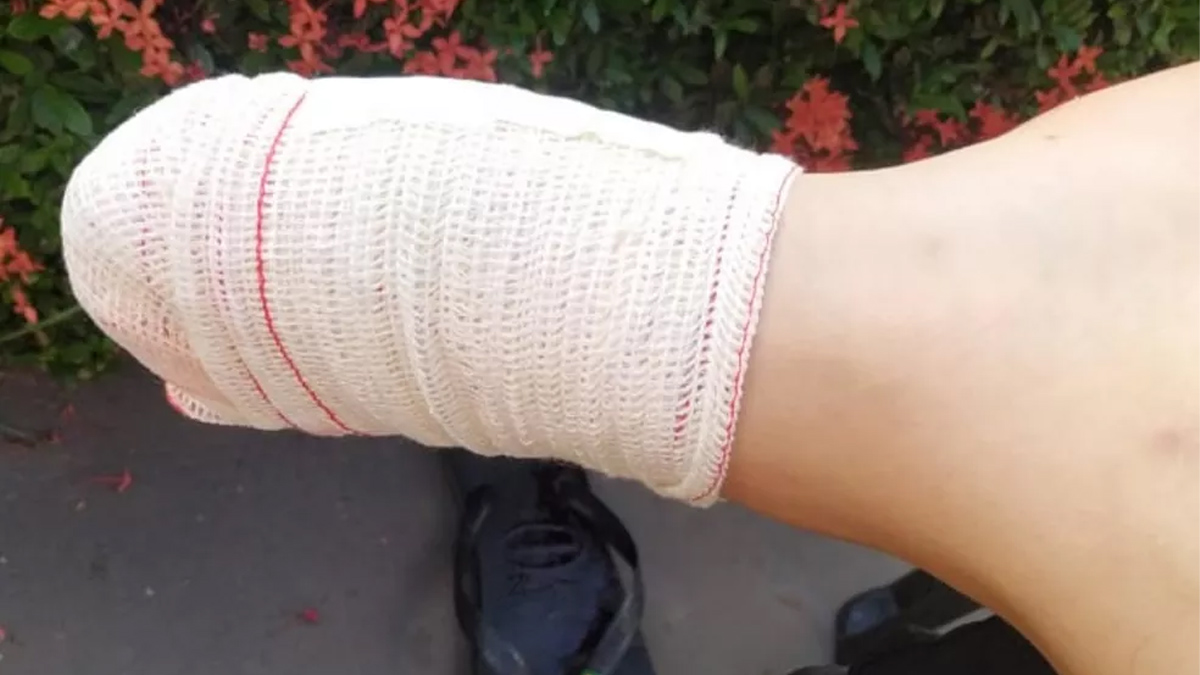 Turista perde parte do dedo em ataque de piranha, em Caldas Novas