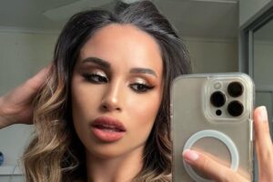 Na web, Jessie Carr foi comparada ao personagem Megamente. Cirurgia plástica malsucedida deforma rosto de modelo australiana; veja