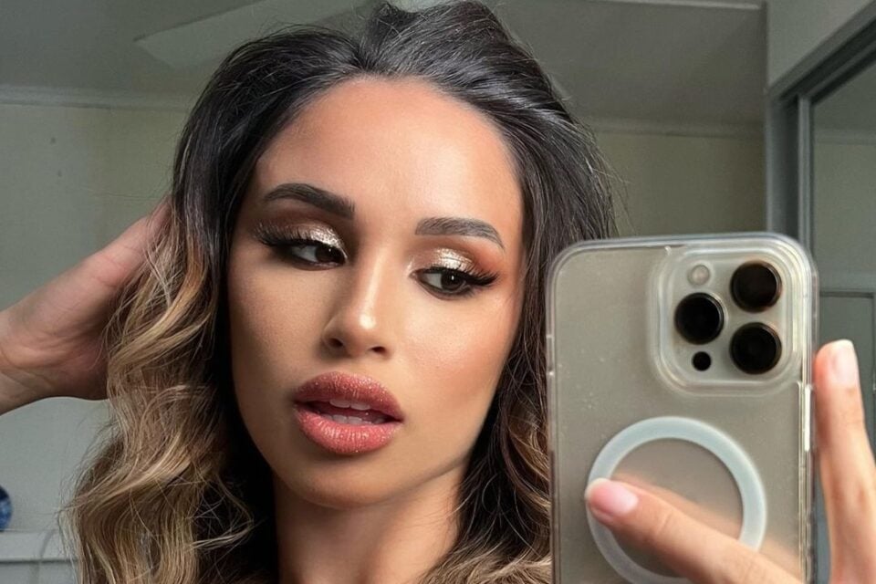 Na web, Jessie Carr foi comparada ao personagem Megamente. Cirurgia plástica malsucedida deforma rosto de modelo australiana; veja