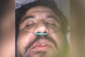 Jornalista da TV Brasil agredido em condomínio sai da UTI