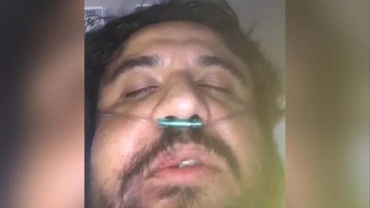 Jornalista da TV Brasil agredido em condomínio sai da UTI