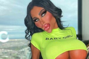 ‘Barbie humana’ da Austrália já gastou mais de R$ 1 milhão em plásticas (Foto: Divulgação)