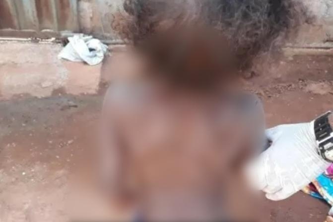 Bombeiros perceberam que os ferimentos no corpo dos irmãos da vítima e acionaram a Polícia Militar