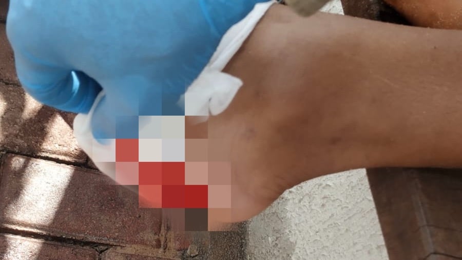 O Lago de Corumbá, situado na cidade de Caldas Novas, registrou o segundo caso de ataque de piranhas em uma semana. Dessa vez, um homem teve o calcanhar do pé mordido enquanto se banhava nas águas, por volta das 15h de sábado (5).