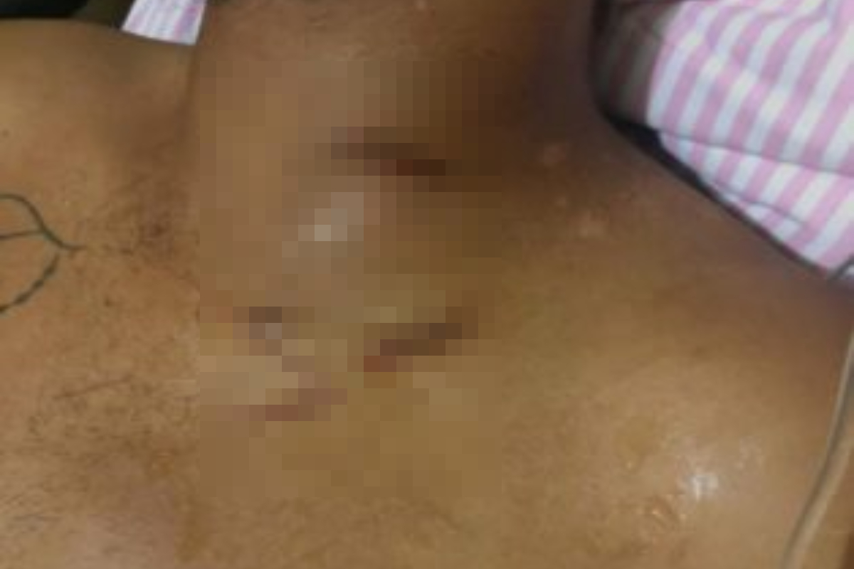 Os dois homens se desentenderam pois o suspeito sentiu ciúmes da namorada com o amigo (Foto: Divulgação – PC)