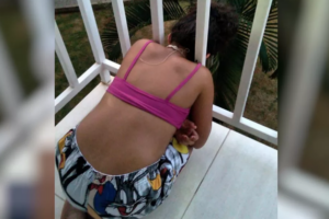 Menina é resgatada após ficar com a cabeça presa em sacada de apartamento em Caldas Novas