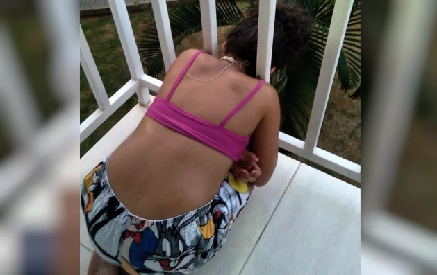 Menina é resgatada após ficar com a cabeça presa em sacada de apartamento em Caldas Novas