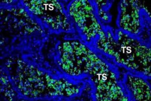 Coronavírus em testículos humanos — (Foto: Guilherme Mattos Jardim Costa/UFMG)