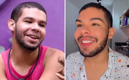 Vyni antes e depois da prótese dentária