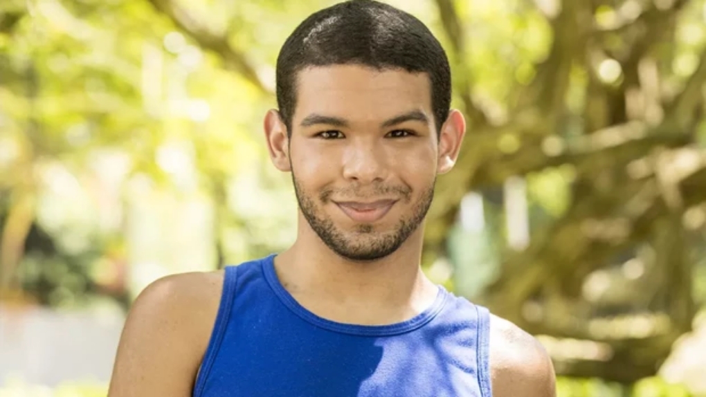 Vyni, do BBB 22, coloca prótese dentária; veja resultado