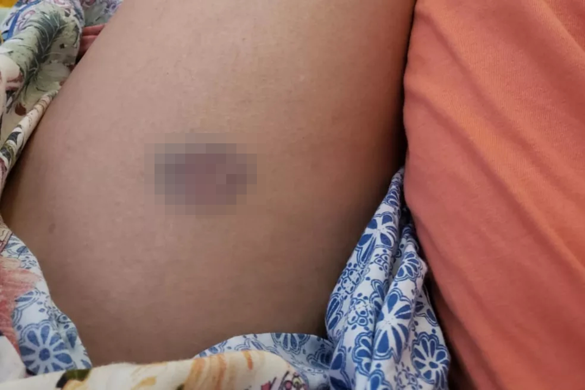 Mulher ficou ferida enquanto tentava afastar advogado que agredia amigo dela (Foto: Reprodução - Arquivo Pessoal)