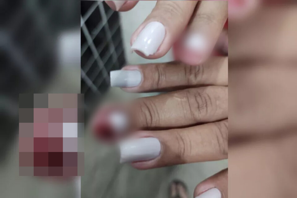 Motorista mostra mãos machucadas durante briga (Foto: Reprodução - PM)