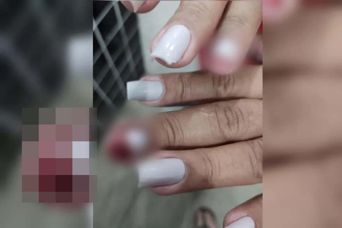 Motorista mostra mãos machucadas durante briga (Foto: Reprodução - PM)