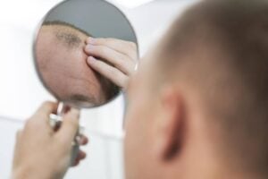 Remédio para combater calvície encomendado pelas Forças Armadas pode causar disfunção erétil Aeronáutica, Exército e Marinha finasterida