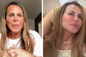 Gretchen rebate críticas: se estou ficando careca, é problema meu