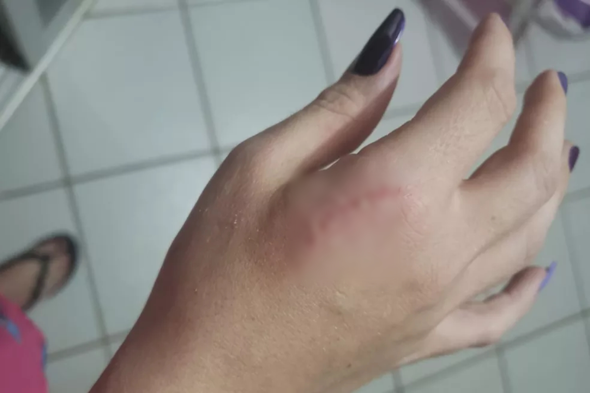 A mulher foi empurrada pelo ex-namorado várias vezes, o que lhe causou ferimentos na mão, braços e perna.
