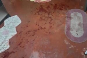 Mulher é suspeita de matar marido em Anápolis