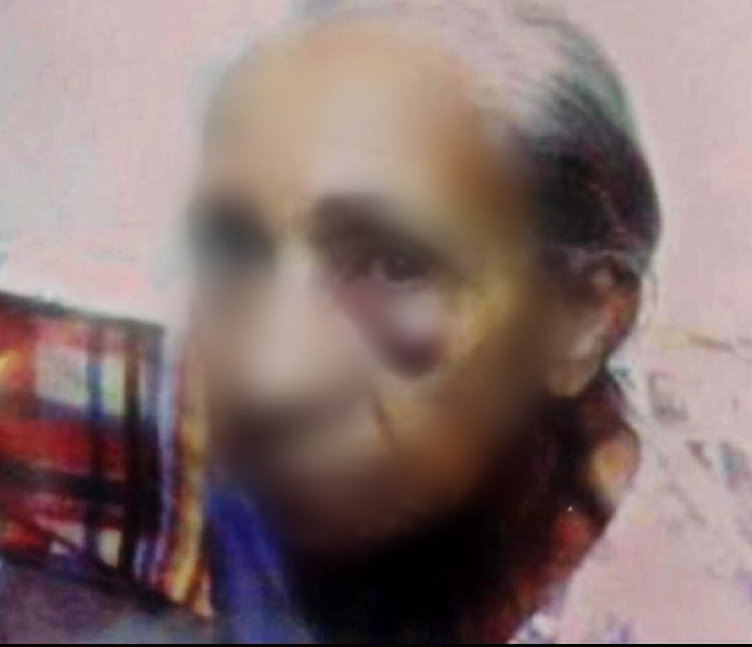 Polícia prende suspeita de cometer maus-tratos contra a mãe de 90 anos, em Goiânia