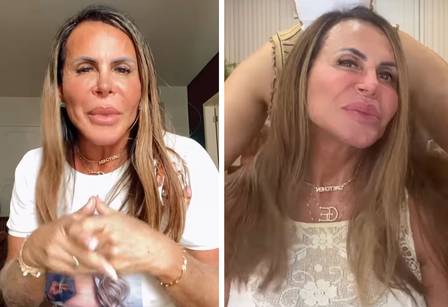"Claro, a galera do mal tem que falar", disse cantora. Gretchen rebate críticas ao novo visual: "Se estou ficando careca, problema meu"