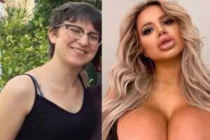 Jessy Bunny gastou cerca de R$ 315 mil em procedimentos. Modelo do Onlyfans passou por cirurgias plásticas para virar boneca Barbie; fotos