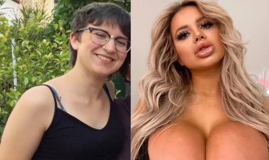 Jessy Bunny gastou cerca de R$ 315 mil em procedimentos. Modelo do Onlyfans passou por cirurgias plásticas para virar boneca Barbie; fotos