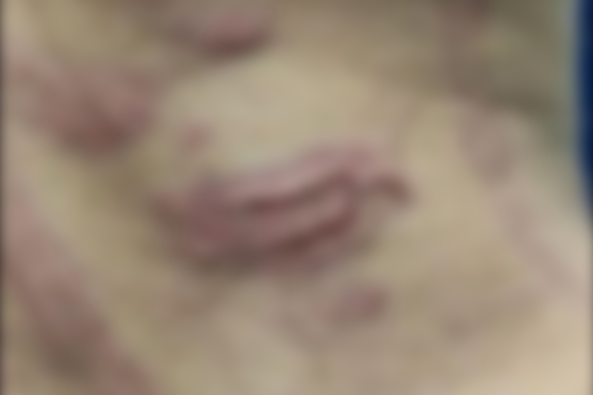 As agressões se concentraram nas costas da mulher, que ficou bastante ferida (Foto: Divulgação – PC)