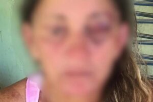 Violência Doméstica em Pontalina