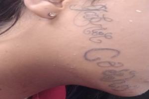 Jovem inicia remoção de tatuagem feita no rosto pelo ex: 'Me sinto livre'