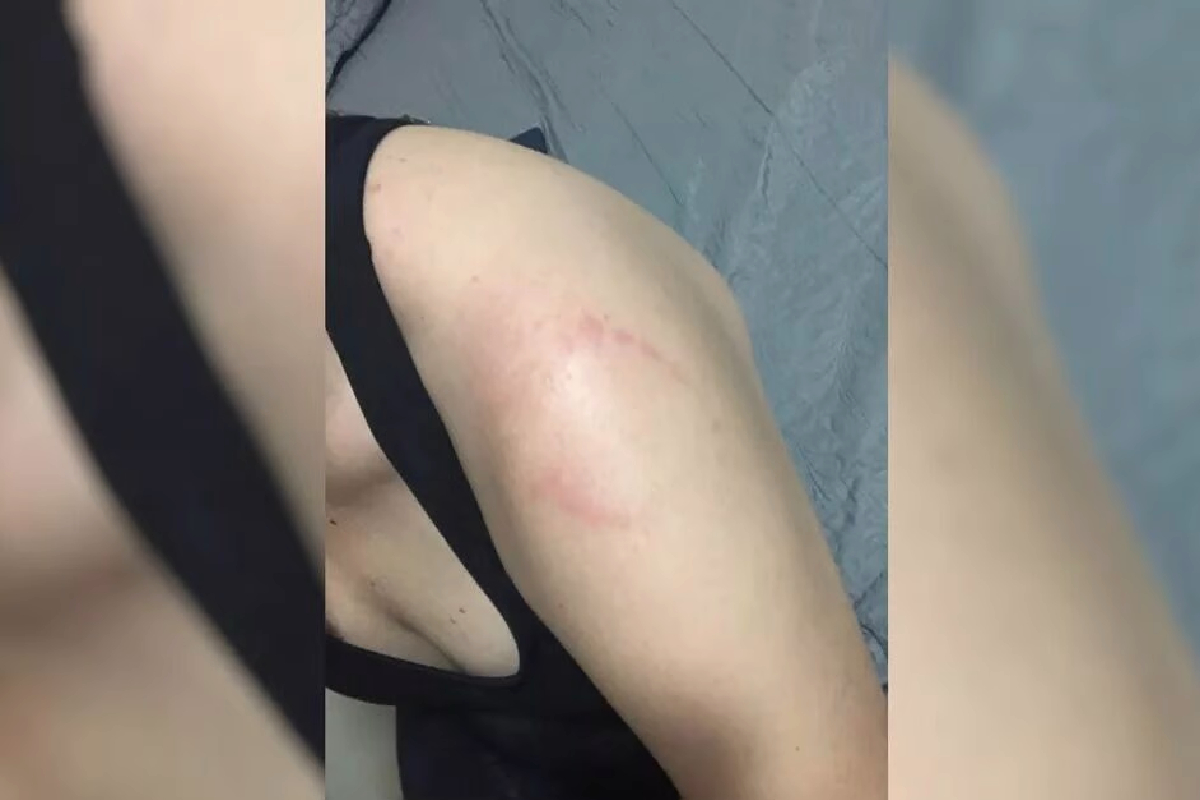 Polícia indicia dentista por morder braço de mulher em academia de Rio Verde (GO)