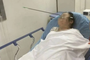 Mulher tem rosto atravessado por flecha de 70 centímetros na China
